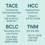 TACE, HCC, BCLC, TNM의 의미를 한눈에 설명하는 인포그래픽